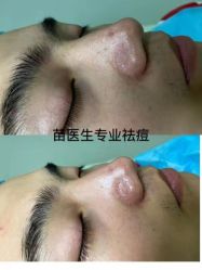 -苗医生专业祛痘·皮肤管理