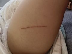 -首都医科大学附属北京潞河医院