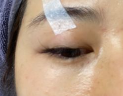 -첫번째 初见美学中心