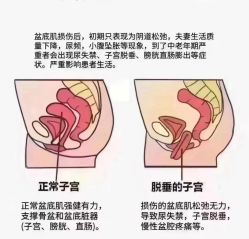 -卡莫瑜伽·普拉提