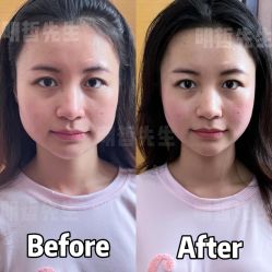 -颜和骨正&明星徒手小颜整骨