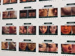 点击看大图 -瓷肌博士·祛痘科技美肤