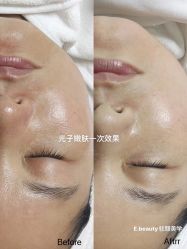 -E.beauty驻颜·痘敏肌调理中心