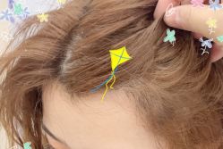 -大麦微针植发全国连锁