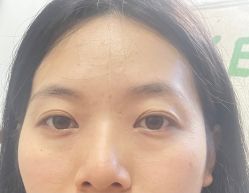 -四川米兰柏羽医学美容医院