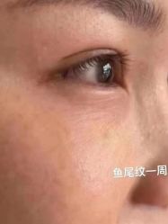 -天津健丽·去眼袋医疗美容机构