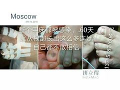 -新甲连锁灰指甲·甲沟炎·鸡眼(黑龙江路店)