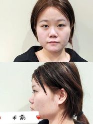 -长沙雅美医疗美容医院