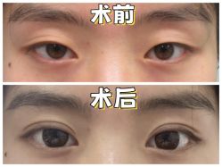 -素美医疗美容·西南眼鼻整形·修复基地
