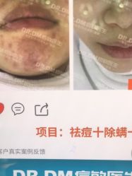 -痘敏医生专业祛痘·肌肤修复连锁