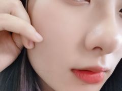 -黑马眼科·近视手术