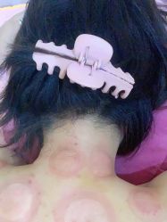 点击看大图 包房-寇氏拔罐减肥