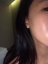 体验后-Hi Beauty Skin 科技美肤中心