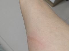 -AOE 火焰 剧本密室狼人杀