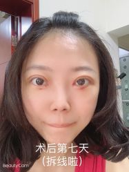 -八大处整形