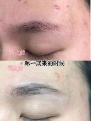 -张小野·专业半永久纹眉