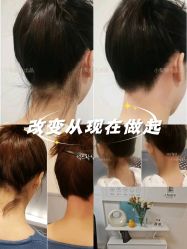 -小梨·OndaPro·专业脱毛连锁机构