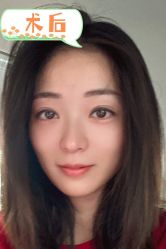 -素美医疗美容·西南眼鼻整形·修复基地