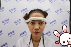 -大麦微针植发丨全国连锁