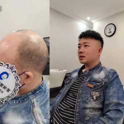 -唐风采假发补发定制