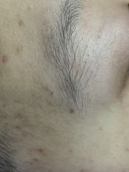 -蕾特恩专业祛痘·皮肤管理