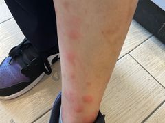 -五七小李子油焖大虾(总店)