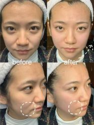 -睿明真达专业皮肤护理中心