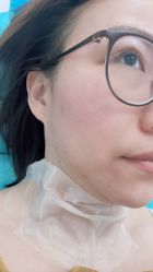 -agge蛋白医美