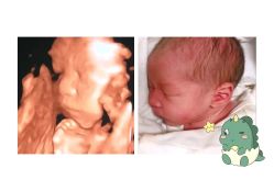 -杭州贝瑞斯美华妇儿医院·早孕·产检·儿科