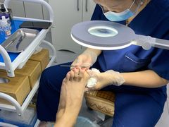 -世龙世家甲沟炎·灰指甲·嵌甲矫正·修脚(武侯区双楠店)