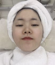 -安那般那皮肤年轻化ANAPANA