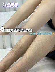 -薇兰专业脱毛连锁机构