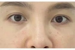 体验前-医颜医疗美容门诊部