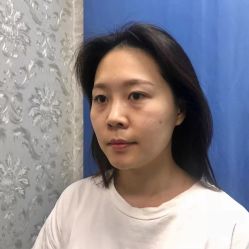 点击看大图 体验前-广州健丽·去眼袋医疗美容机构