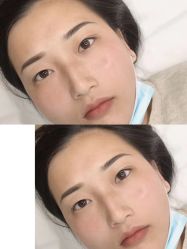 -久匠半永久纹眉