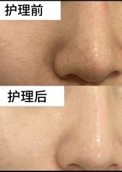 -SKIN79皮肤管理中心