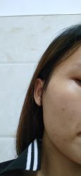 -广州美莱医疗美容医院