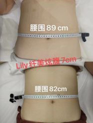 -Lily纤美·科技减脂中心