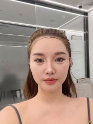 -熙朵美学植发·连锁品牌