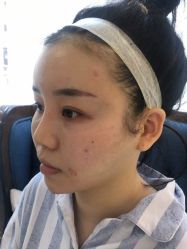 -深圳悦她医疗美容