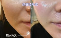 -栖SPA·ONDA ·海菲秀·皑皑科技美肤中心
