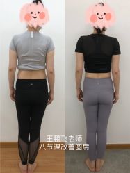 -卓拓普拉提