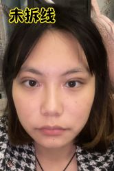 -素美医疗美容·西南眼鼻整形·修复基地