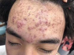 点击看大图 -蕾特恩专业祛痘·皮肤管理