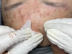 -Cream88颜皮肤管理中心