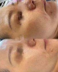 -彼家美创·量肤定制修护管理