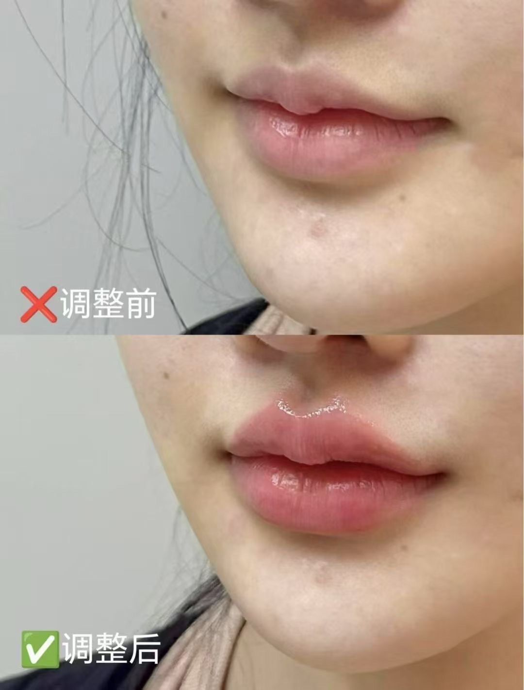 即刻焕发嘟嘟唇