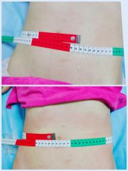 -清媚减肥瘦身纤体