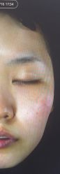 体验前-Dr.U博士医疗美容医院