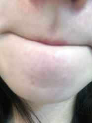 -丽美妍医疗美容·皮秒·立体分层抗衰